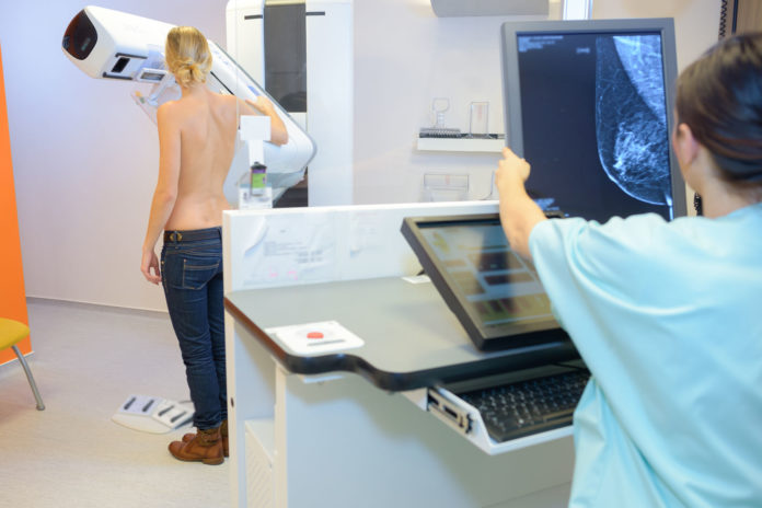 cancer, mamographie, inégalités 123 RF ©