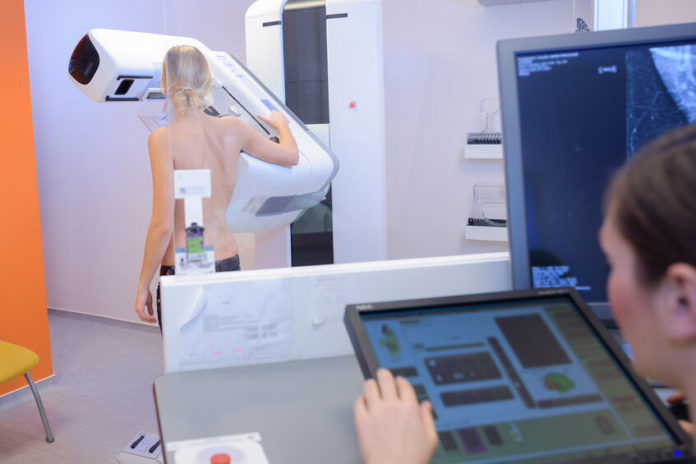 Vers moins de traitements lourds pour les femmes atteintes d'un cancer du sein 123RF©