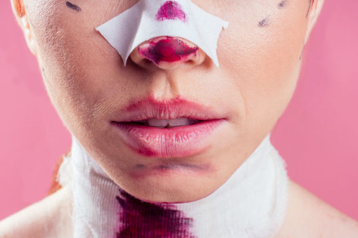 Patiente avec bandages sur le visage