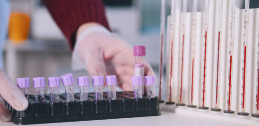 Les infections sexuellement transmissibles (IST) se répandent en Europe. © 123 RF